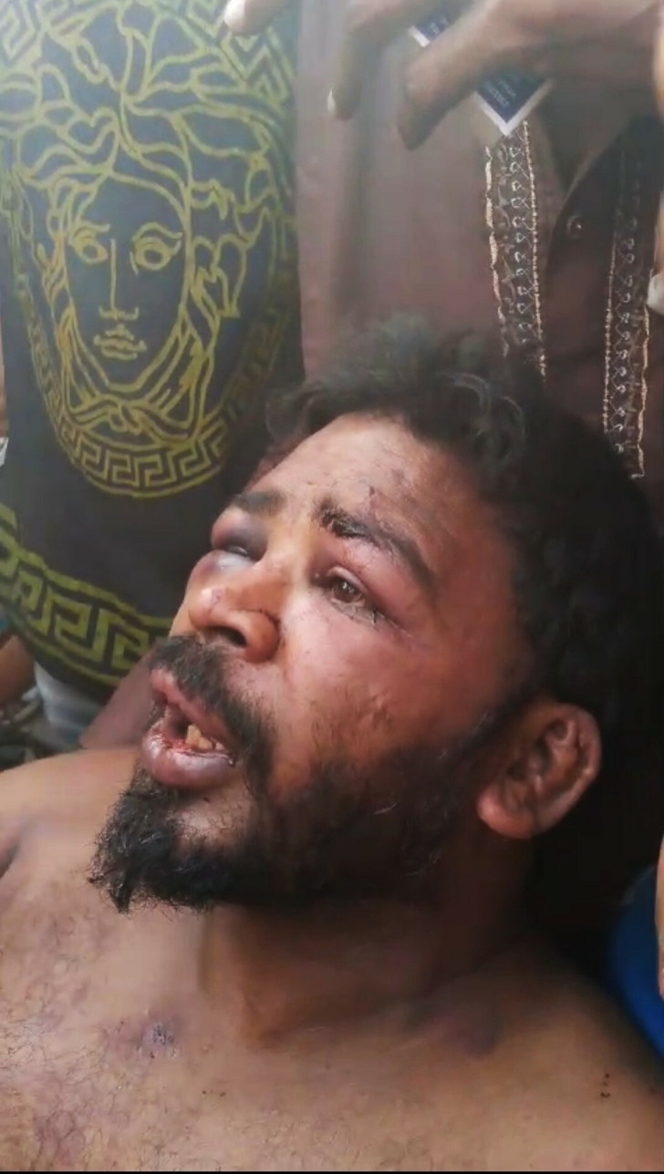 Christian sanitation worker Yasir Masih was tortured in the Gujjarpura area of Lahore, Pakistan on May 25, 2024. 