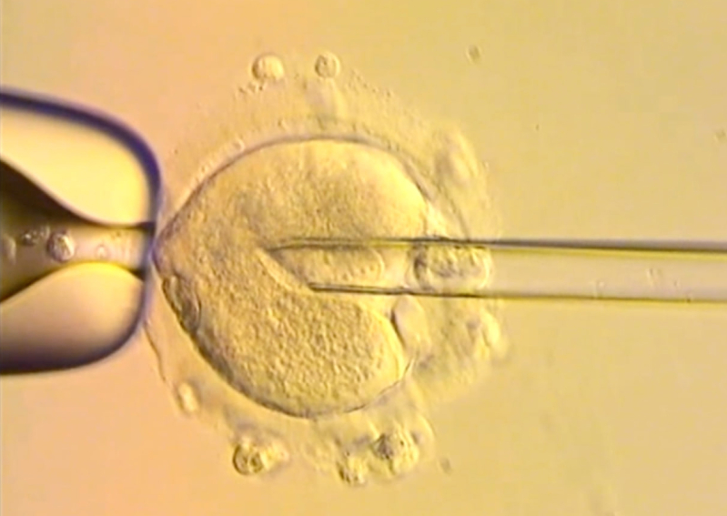 A still from a BBC video shows the critical moment DNA from two parents is transferred into a donor egg—an essential step in creating a baby using DNA from three individuals to prevent mitochondrial disease.