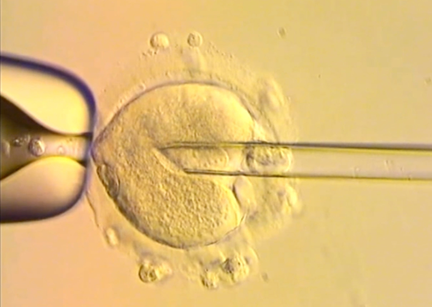 A still from a BBC video shows the critical moment DNA from two parents is transferred into a donor egg—an essential step in creating a baby using DNA from three individuals to prevent mitochondrial disease.