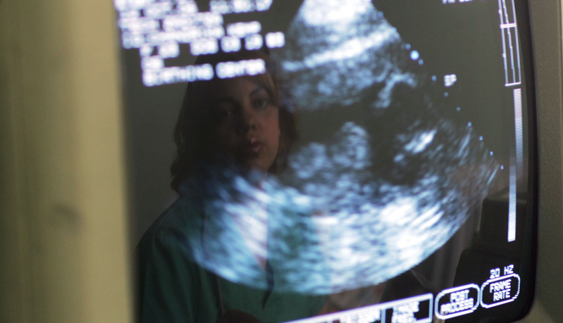 Ultrasound