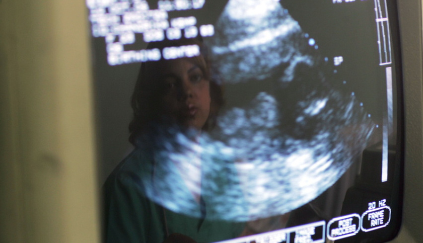 Ultrasound