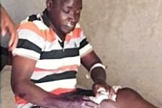 Pastor John Michael Okoel and his assistant pastor of Pallisa, Uganda were beaten for their faith on Jan. 30, 2026.