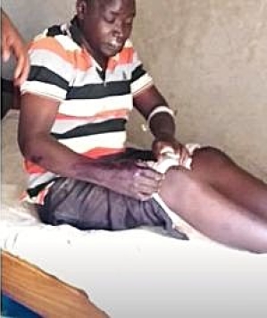 Pastor John Michael Okoel and his assistant pastor of Pallisa, Uganda were beaten for their faith on Jan. 30, 2026.