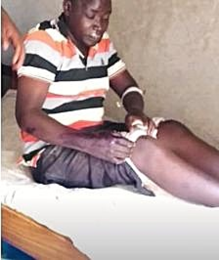 Pastor John Michael Okoel and his assistant pastor of Pallisa, Uganda were beaten for their faith on Jan. 30, 2026.