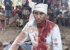 Sukra Madi was beaten for his faith on June 21, 2025 in Kotamateru village, Malkangiri District, Odisha state, India.