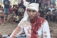 Sukra Madi was beaten for his faith on June 21, 2025 in Kotamateru village, Malkangiri District, Odisha state, India.