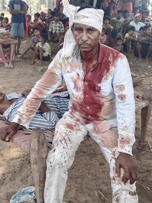 Sukra Madi was beaten for his faith on June 21, 2025 in Kotamateru village, Malkangiri District, Odisha state, India.