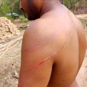 Pastor Motu Sodi was attacked with wooden sticks in Sukma District, Chhattisgarh state, India, on April 13, 2026.