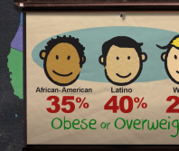 Severe obesity growing in American children under 5 is ‘nearly irreversible’: study