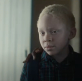 Zambian Netflix film addresses issues of prejudice for albinos in Africa