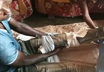Two evangelists severely beaten in eastern Uganda