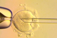 UK babies born using DNA from three people raise ethical questions