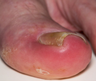 A toe, a tooth, and the theology of perspective