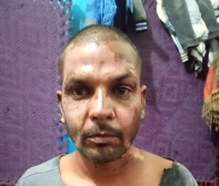 Muslim in Pakistan sets Christian on fire over petty dispute