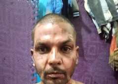 Muslim in Pakistan sets Christian on fire over petty dispute