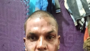 Muslim in Pakistan sets Christian on fire over petty dispute