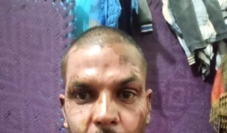 Muslim in Pakistan sets Christian on fire over petty dispute