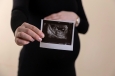 Dutch Christians push back on plan to expand late-term abortions for 'social reasons'
